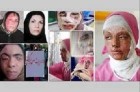اسیدپاشی روی یک مادر و دختر سقزی
