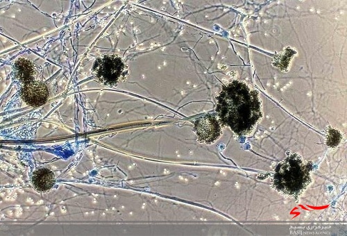 تاکنون گزارشی از ابتلا به قارچ سیاه در البرز نداشته&zwnj;ایم