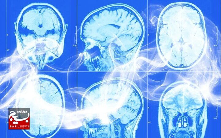 ارتباط بین مصرف سیگار و بیماری کُشنده مغزی