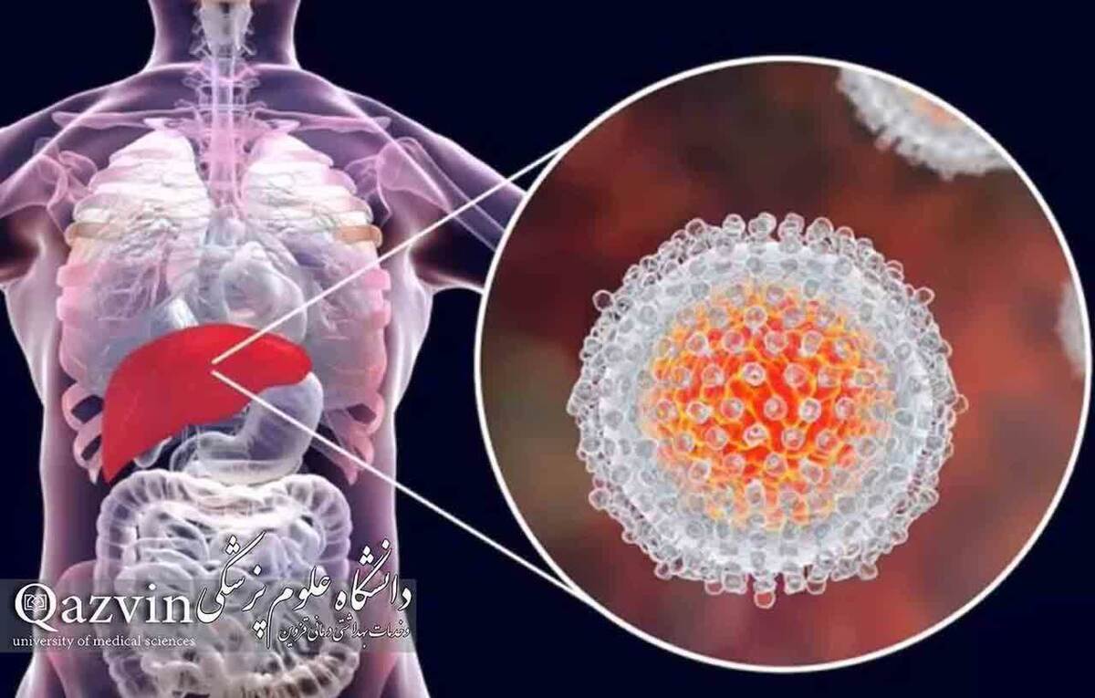 هپاتیت‌ ویروسی «B» و «C»، قابل پیشگیری و درمان هستند