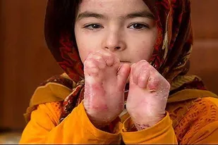 ای بی واگیردار نیست اما ایمان را می گیرد