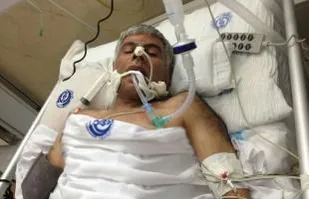 برای درمان جانبازان شیمیایی،اول پول می خواهند بعد درمان/دولت از حقوق ما در دادگاه لاهه دفاع کند