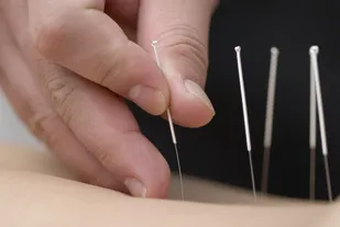 دوره&zwnj;های آموزشی طب سوزنی پژوهشکده اسلام و سلامت پایدار برگزار می&zwnj;شود