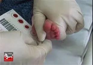 شناسایی ۱۱ نوزاد مبتلا به کم کاری تیروئید در مه ولات