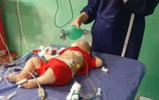 نجات کودک ده ماهه خرمشهری با تلاش  پزشکان