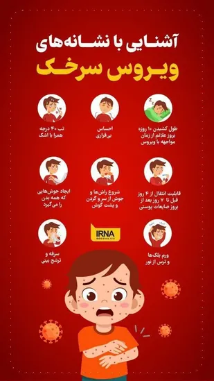 اینفوگرافی/ آشنایی با نشانه های ویروس سرخک