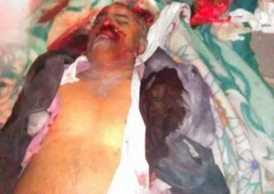 حمله به جلسه فرهنگیان استان عمران 51 قربانی گرفت