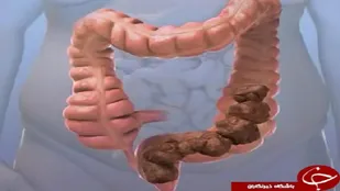 نقش صبحانه در پیشگیری از ابتلا به یبوست