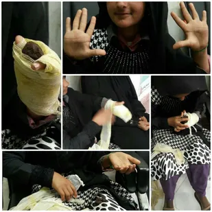 انگشتان قطع شده دختر متکدی در کلانتری شاهرود سبز شد