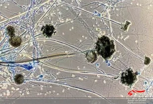 تاکنون گزارشی از ابتلا به قارچ سیاه در البرز نداشته&zwnj;ایم