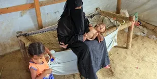 یک میلیون زن باردار یمنی در خطر سوءتغذیه شدید قرار دارند