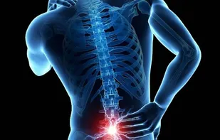 کمر درد، مشکلی جدی یا یک اتفاق طبیعی؟