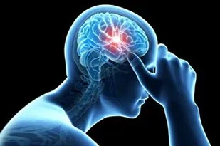 آیا کرونا خطر سکته مغزی را افزایش می&zwnj;دهد؟