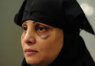 نقض فاحش حقوق بشر