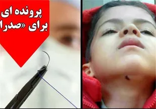 جدیدترین جزئیات رخداد تلخ "بخیه"