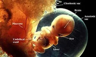 بروز مسمومیت حاملگی به دلیل فشار خون بالا
