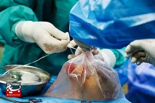 &nbsp;اهدای اعضای جوان ۲۶ساله در گناباد به چهار بیمار زندگی بخشید