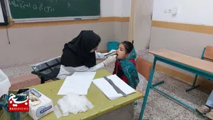 پایش سلامت دهان و دندان دانش آموزان چورت انجام شد