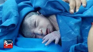 نجات مادر باردار و تولد نوزادی سالم پس از جراحی فک در بیمارستان خاتم الانبیاء(ص) زاهدان