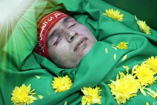 زخم های صورت رنگ پریده ات گواه همه ناجوانمردی هاست