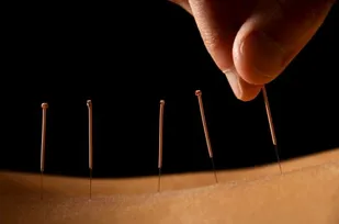 عوارض ترک اعتیاد با طب سوزنی بسیار کمتر از متادون درمانی است