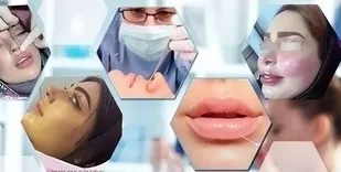 رد پای &laquo;ژل&zwnj;های سرطانی&raquo; بر صورت دختران ایرانی&zwnj;