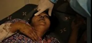 بیماری خاموش قارچ سياه همچنان در هند قربانی می&zwnj;گیرد