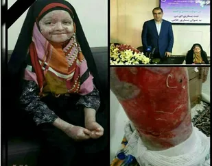 مجلس بیماری &laquo;ای بی&raquo; را جزو بیماران خاص قبول نمی کند/فقط ماهی 54هزار تومان به ما می دهند
