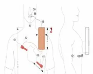 احیاگر قلب ساخت شاهرود طلای جشنواره کره جنوبی را گرفت