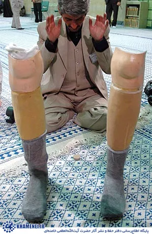 درد و دل یک جانباز/ عدم توجه به مشکلات جانبازان