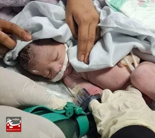 احیای موفق نوزاد توسط اورژانس بانوان زاهدان پس از زایمان پرخطر