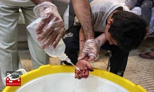 راهکارهای مقابله با سوختگی در چهارشنبه سوری