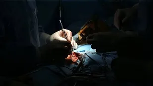 کاشت باتری قلبی زیرجلدی (S-ICD) برای اولین بار در تبریز انجام شد